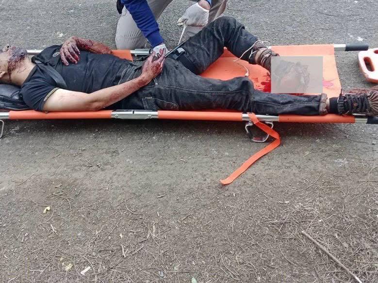 អាជ្ញាធរមីនកម្ពុជា បដិសេធដាច់ខាតការចោទប្រកាន់របស់ថៃ ករណីផ្ទុះមីននៅព្រំដែន